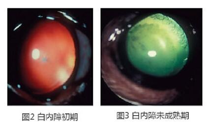 一隻貓貓患白內障之後既日記 寵物台 香港高登討論區