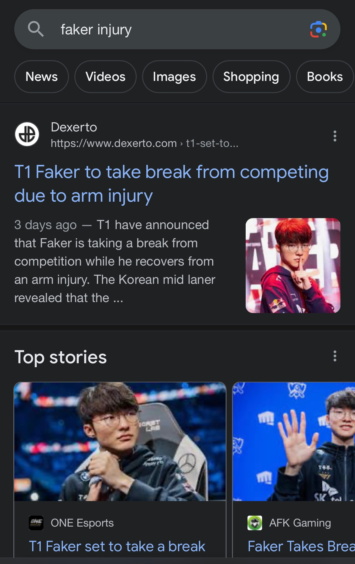 T1 Faker to take break from competing due to arm injury - Dexerto